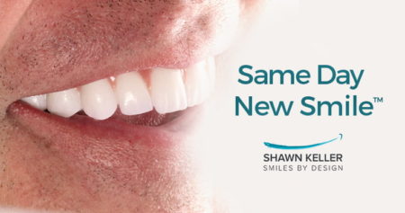 Same Day New Smile by Shawn Keller Smiles by Design