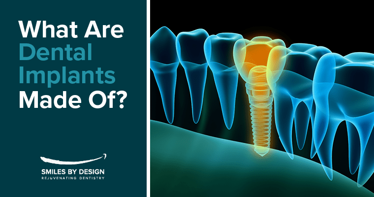 What Are Dental Implants Made Of?