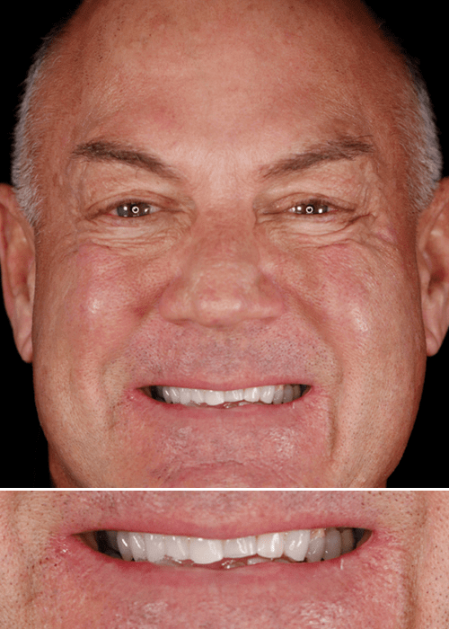 Headshot of Joe before receiving cosmetic treatment