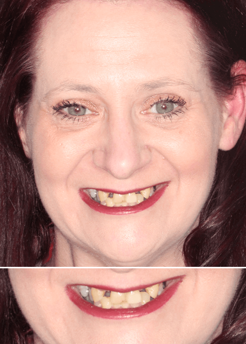 Headshot of Leanne before receiving cosmetic treatment